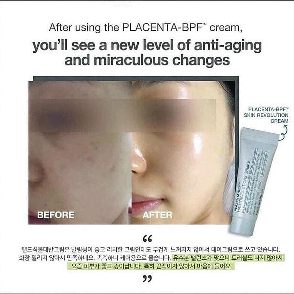 Feld-apotheke Placenta BPF Skin Revolution Cream skin